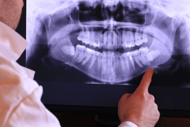 Best Broken or Chipped Tooth Repair in Three Forks, MT